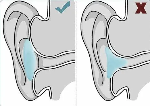 Deez Silicone Ear Plugs